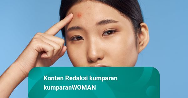5 Skincare Korea untuk Jerawat yang Bikin Kulit Makin Mulus | kumparan.com